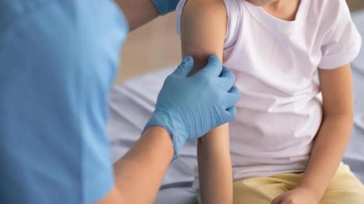 Самая эффективная защита от кори – вакцинация